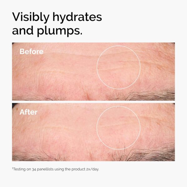 The Ordinary Hyaluronic Acid 2% + B5 (with Ceramides), Multi-Depth Hydration Serum for Plumper, Smoother Skin, 1 Fl Oz - Image 3